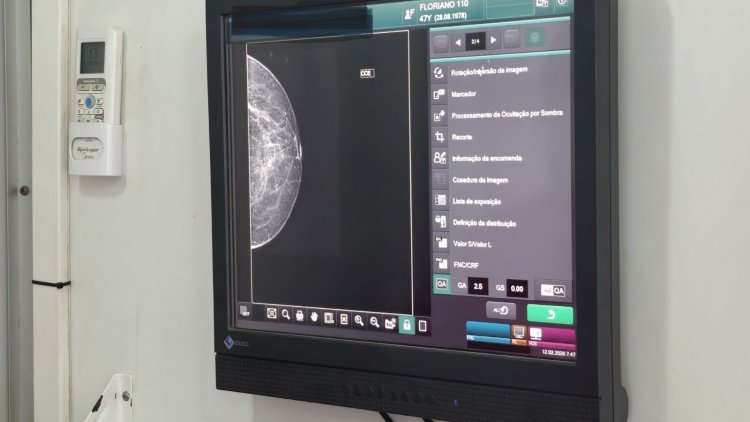 Caminhão da Mamografia realiza em Floriano exames gratuitos pelo SUS