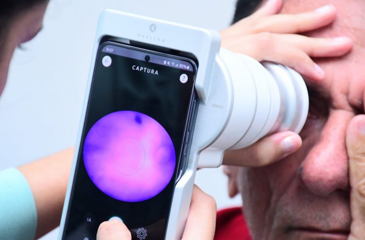 Floriano é contemplada com projeto inovador de IA para diagnóstico precoce da retinopatia diabética nas UBSs